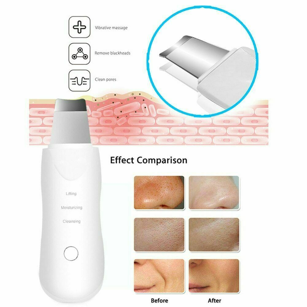 Skin Scrubber Face Spatula - Skin Spatula Blackhead Remover Pore Cleaner with 4 Modes